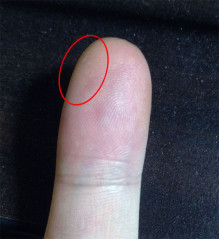 変なとこが固くなっちゃった?（画像あり）